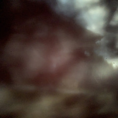 Oppositional defiance