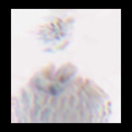 Asfixia