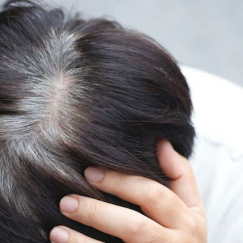 Mơ Thấy Tóc Bạc Là Điềm Gì? Giải Mã Ý Nghĩa Và Các Điềm Báo Từ Giấc Mơ