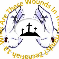 What Are These Wounds In Thine Hands Zechariah 13
