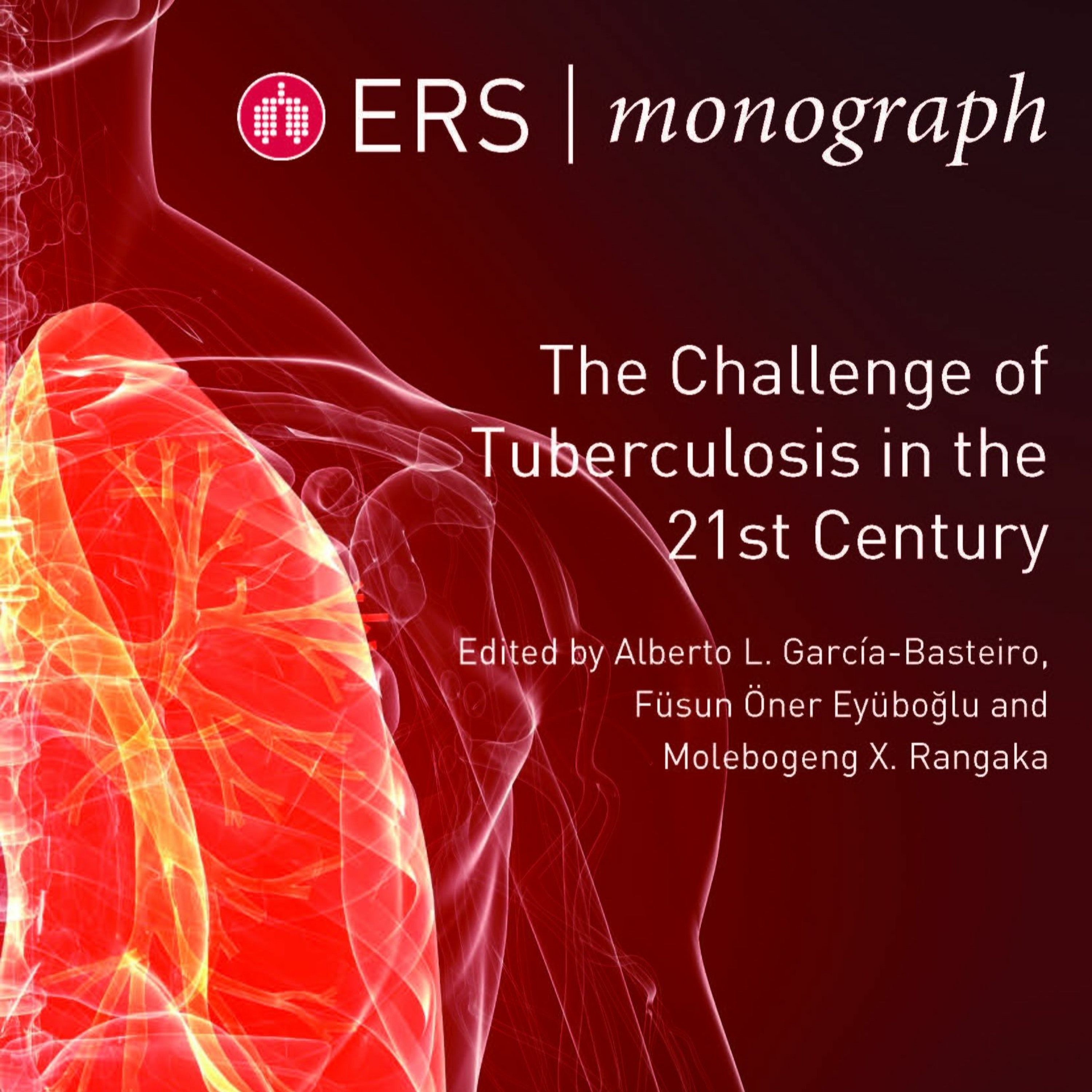 ERS Monograph: The Challenge of Tuberculosis in the 21st Century
