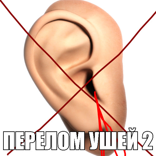 ПЕРЕЛОМ УШЕЙ 2
