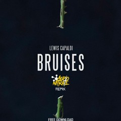 Lewis Capaldi - Bruises (Audio Nitrate Remix) ✅FREE DOWNLOAD✅