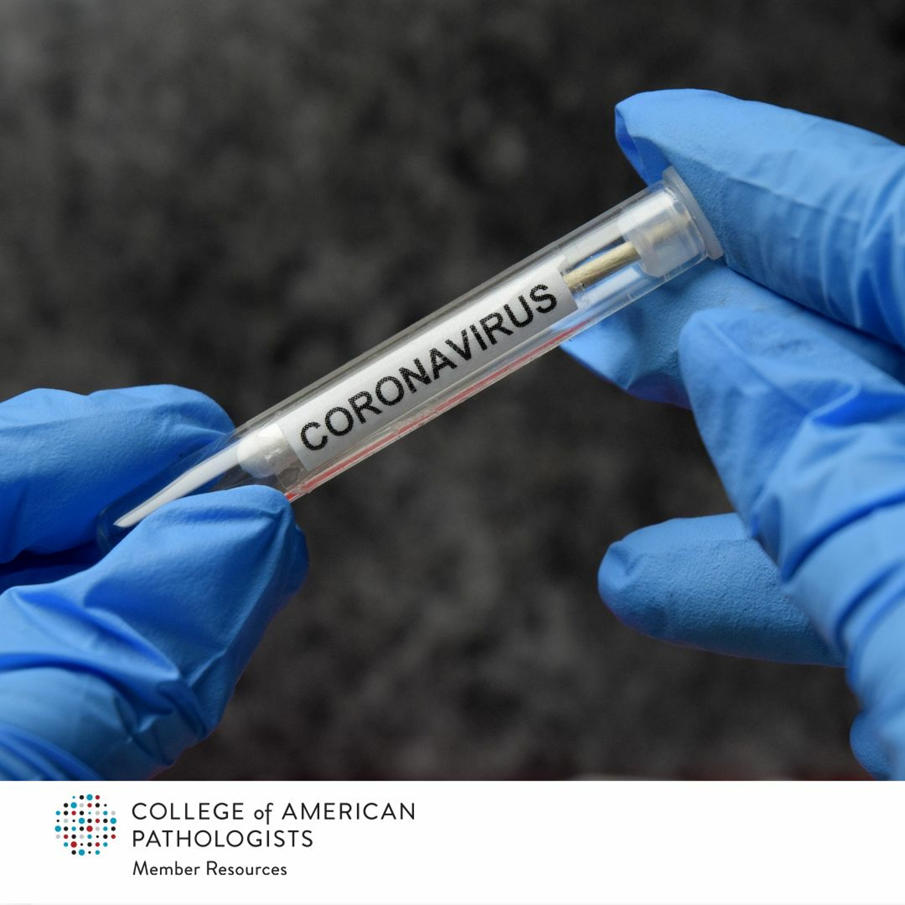 Diagnosing COVID-19 - Advice from UW Pathologists on Ramping Up Testing Capacity episode artwork