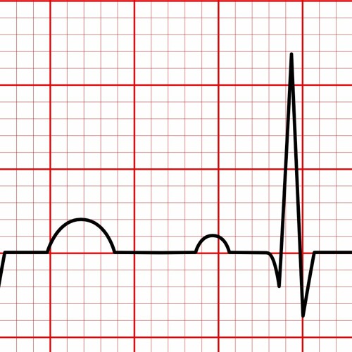 Sinus Rhythms 2021