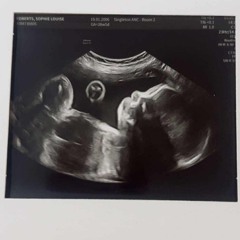 My Little Princess