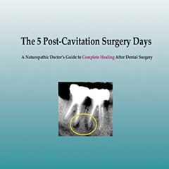 Get KINDLE 💕 The 5 Post-Cavitation Surgery Days: A Naturopathic Doctor's Guid to Com