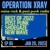 Artwork for OP XRAY EP 85 - Best of 2022 - Part 2 - 79 songs