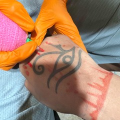 bleedin w k6sn(406ahmad)