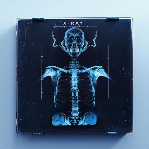 X-RAY [FREE DOWNLOAD]
