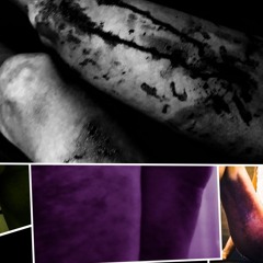 Emergence Delerium