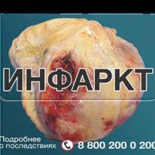 Сдохни