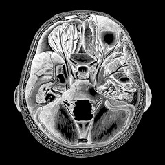SEIREN - Get The Fuck Outta My Head