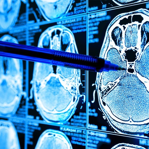 AI in Biomedical Imaging: Transforming Microscopy and Diagnostics