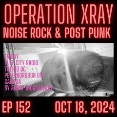 OPERATION XRAY EP 152 - OCT 18, 2024