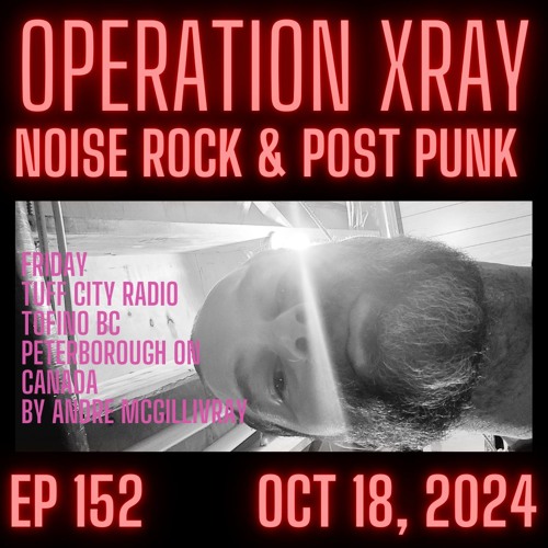 OPERATION XRAY EP 152 - OCT 18, 2024