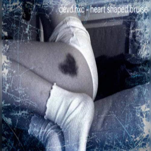 heart shaped bruise (prod. aki)
