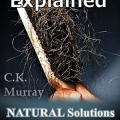 [ACCESS] EBOOK 🗸 Hair Loss Explained: Natural Solutions for Hair Loss and Premature
