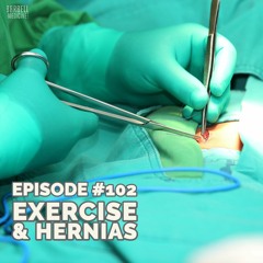 Episode #102: Hernias