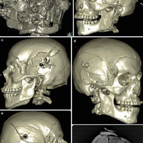 Lil Jeff x Rell Vert-Stretched Remix