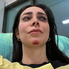 faceplant