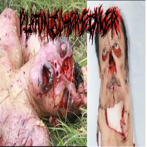 maggot infested rotting prostitute