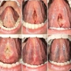 ihateevery1 **#part 2 )glossalia//dj330(