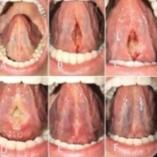 ihateevery1 **#part 2 )glossalia//dj330(