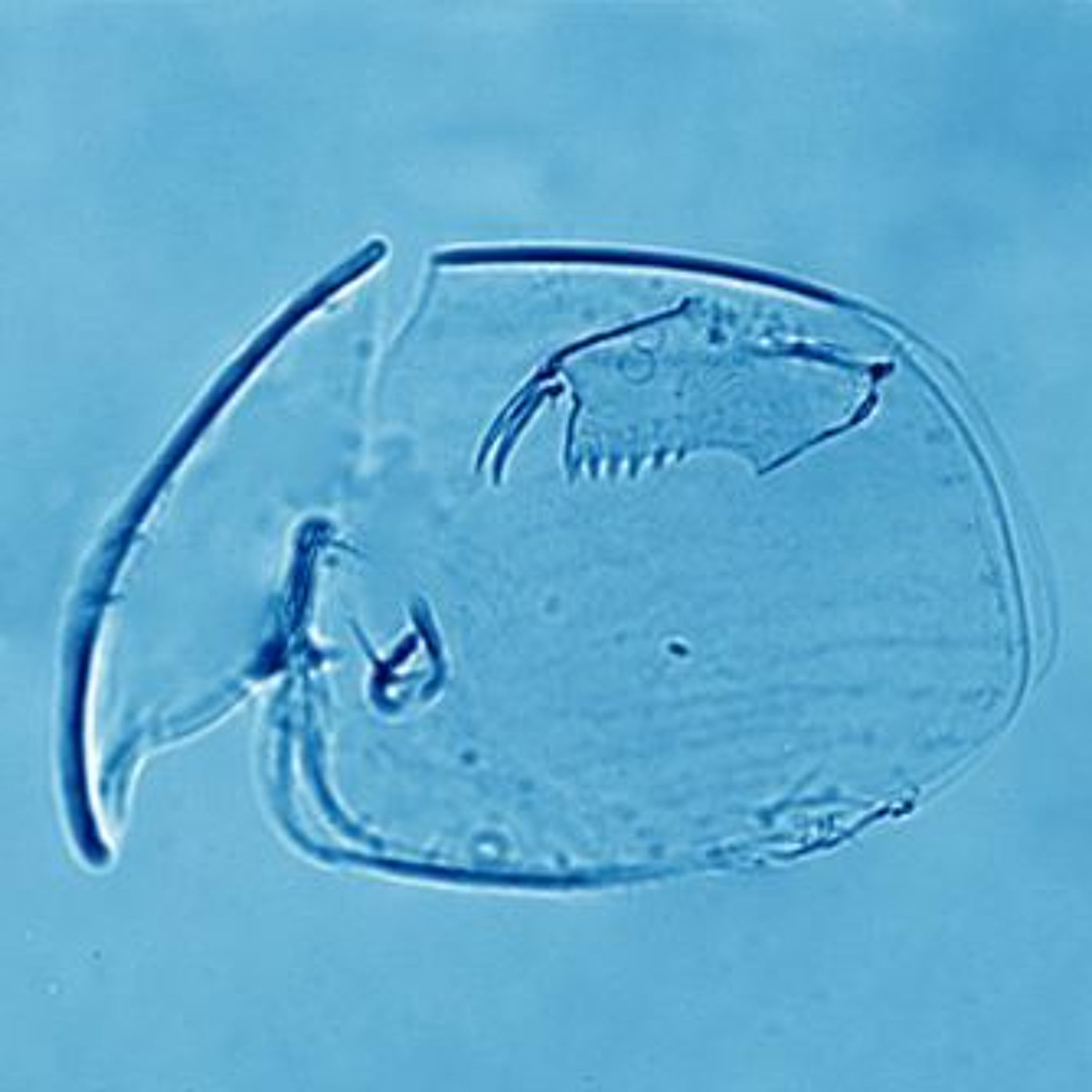 Core Ideas - The Paleolimnology Podcast