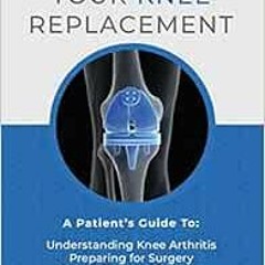 Read [PDF EBOOK EPUB KINDLE] Your Knee Replacement: A Patient's Guide To: Understanding Knee Art