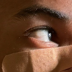 7 STAGE DEMENTIA PROJECT