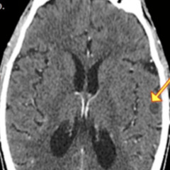 quiz_2025_03_02