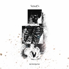Scars (prod. Irby)