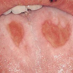 SUGAR SINGED TASTEBUDS (PROD. wonderlust beats)