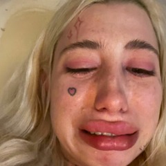 Kanistra /w hofmannita