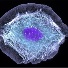 conexion - superposition