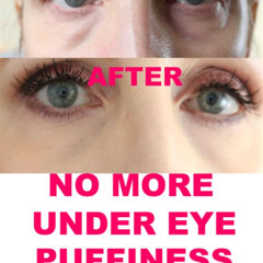 Best Treatment For Puffy Under Eye Bags Reviews
