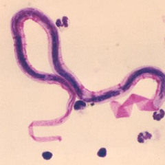 Parasite