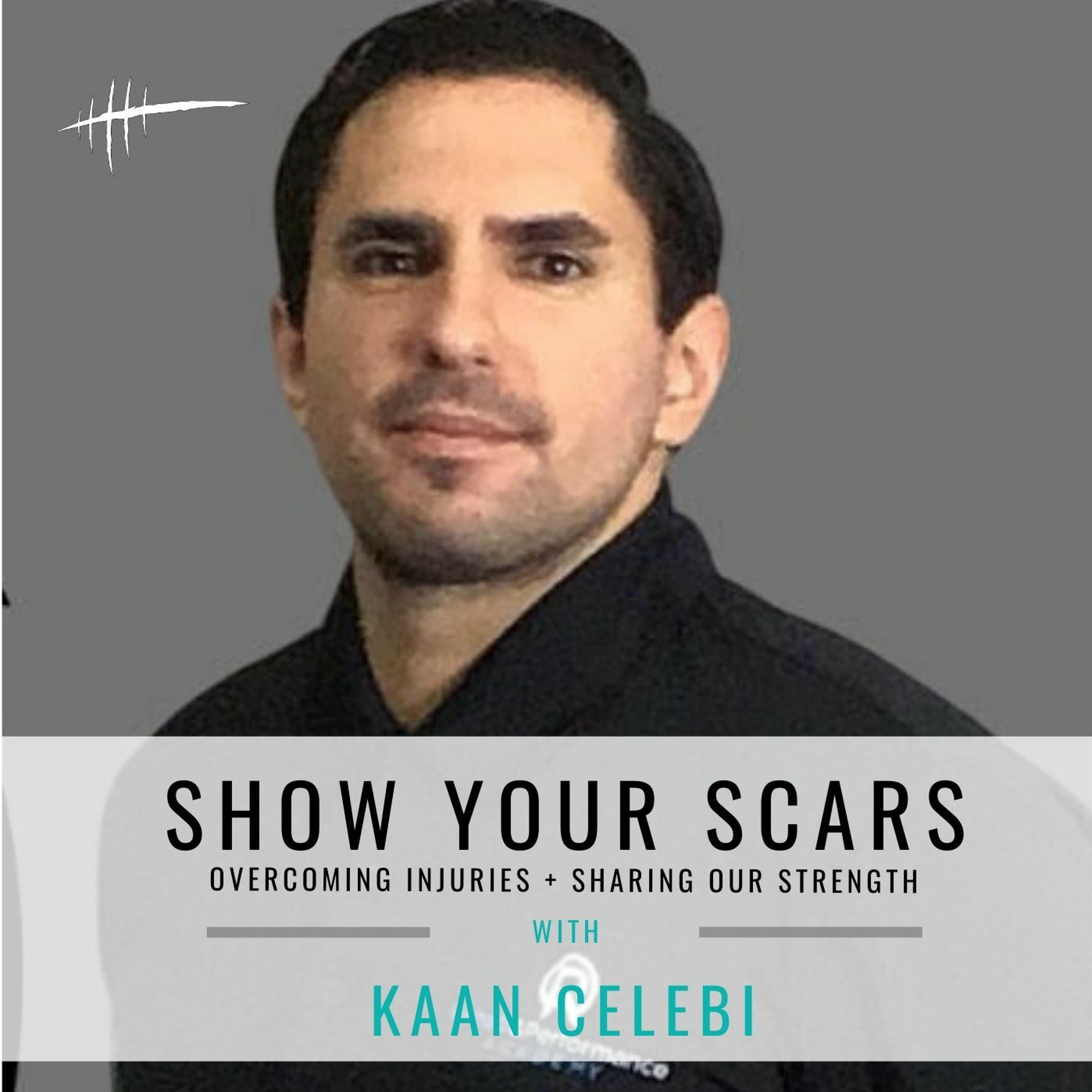 Show Your Scars