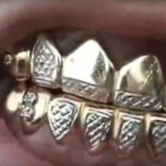 SoDAMitBEAT - HOMIE(ft. $OBER K.O.T ACID$HORA VLONELY!)