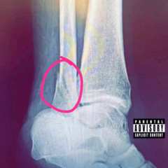 Worldwide Gary "Snow Storm Baby" (Ankle Tape)