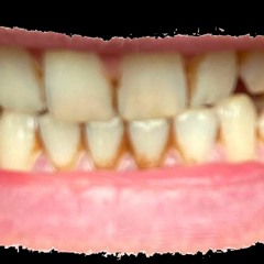 Pulling Teeth (demo '23)