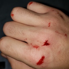 Bloody Knuckles (pro. Messiah)