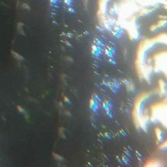 BURN V1