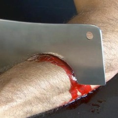 Scarfices