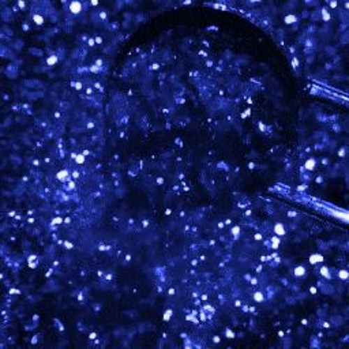 [@1lildyee] Overdone! (prod. xarkr x biggity) #UnderGroundRadio