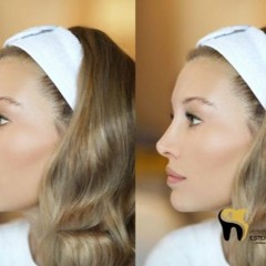 Chirurgie Esthétique