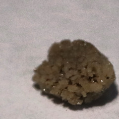 251116 - Kidney Stone 1