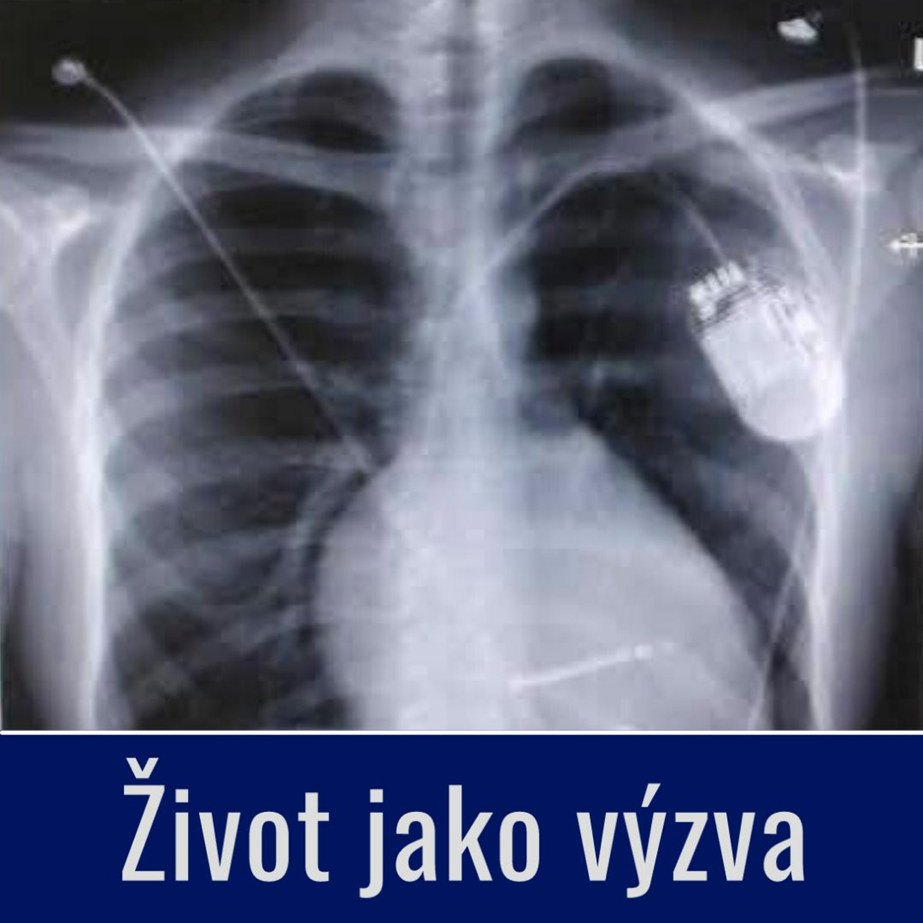 Život jako výzva