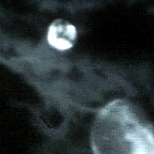 Deine Blicke wie der Mondschein (OUT ON SPOTIFY)